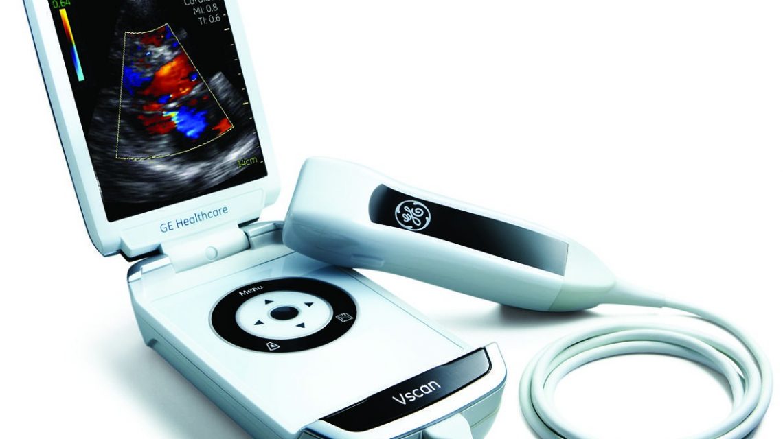 Vscan Pocket sized ultrasound